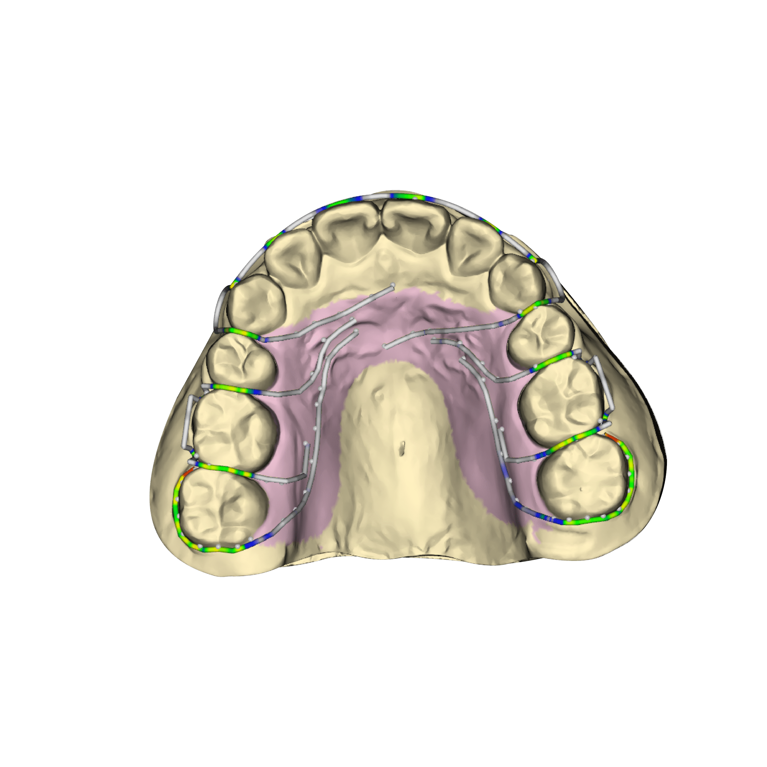 iPDenture Ortho
