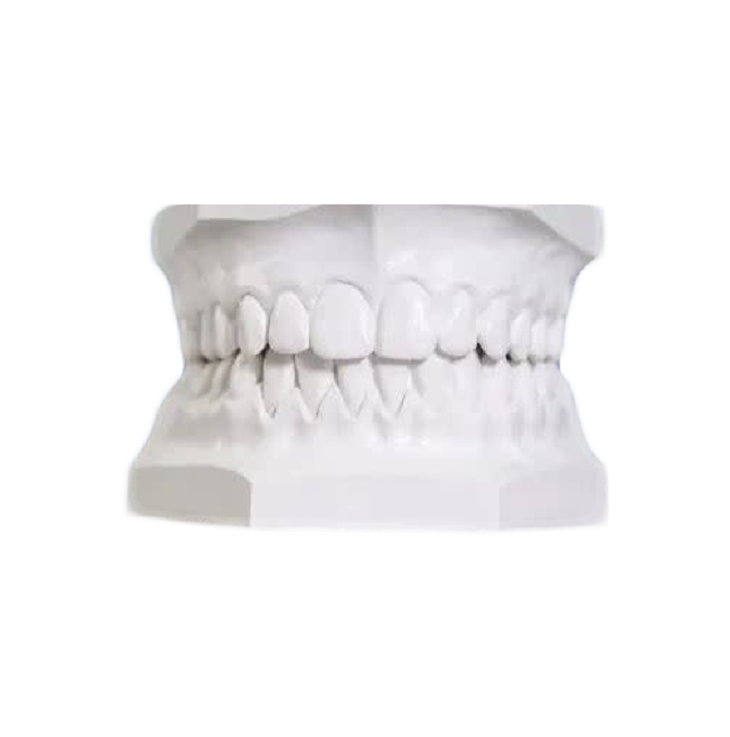 Dental Plaster Teeth.jpg